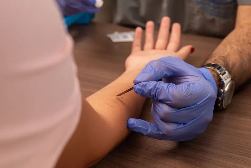 Dr. Daniel Amaya realizando prueba Prick Test de alergia en consultorio de Medellín