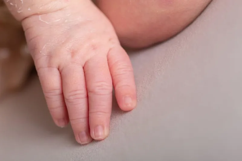 Dermatitis atópica: Tratamientos para el cuidado de la piel