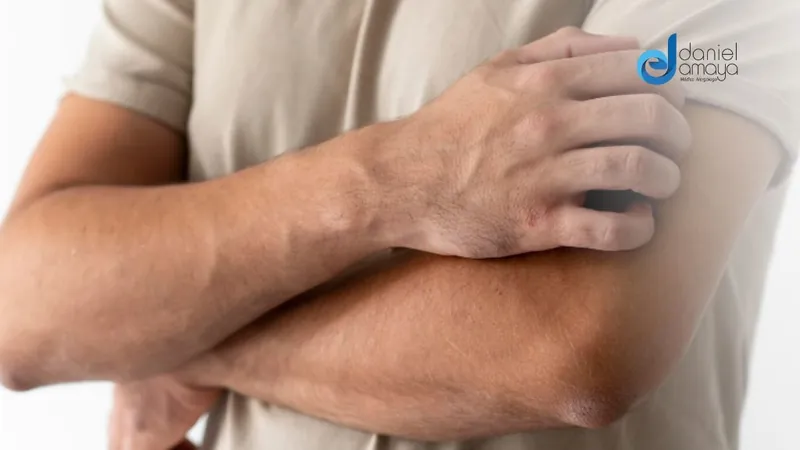 Entendiendo la dermatitis alérgica: Desde las causas hasta los tratamientos