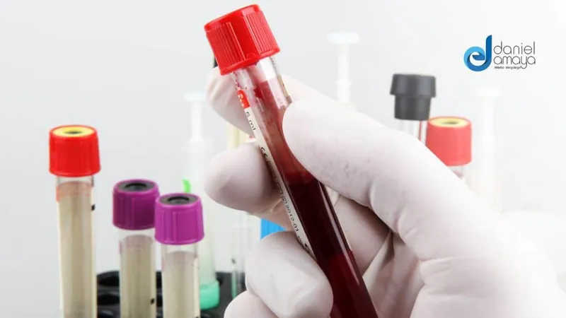 Lo que debes saber antes de hacerte el examen A200 para alergias alimentarias