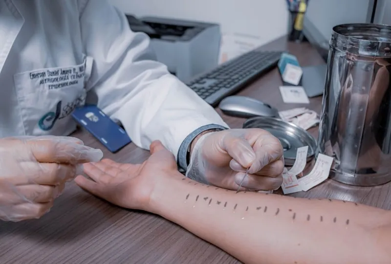 Prueba de alergia: Tipos y usos