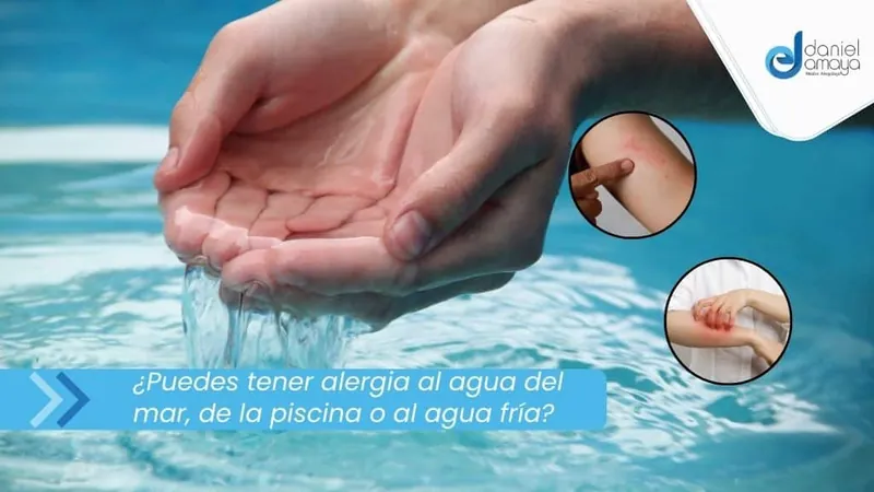 ¿Puedes tener alergia al agua del mar, de la piscina o al agua fría? Esto dice la ciencia