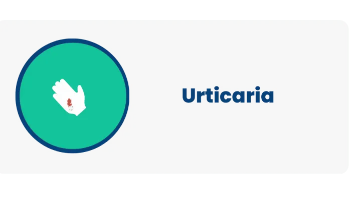 Urticaria