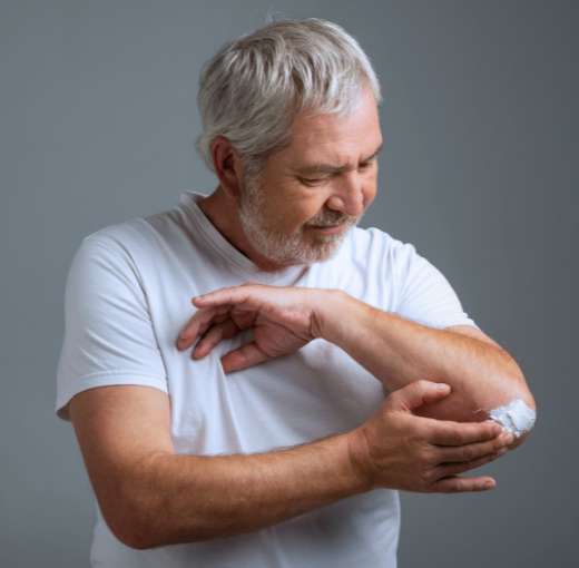 Dermatitis Atópica en adultos Dr. Daniel Amaya Dermatitis Atópica en adultos Dr. Daniel Amaya